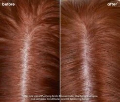 Biolage Scalp Sync Clarifying Shampoo 400ml 11 Biolage Scalp Sync Clarifying Shampoo 400ml -Price Attack Shop Biolage 2023 Scalp Sync Oily Before After Shannon Closeup 968x828 1